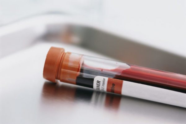 Анализ крови на билирубин