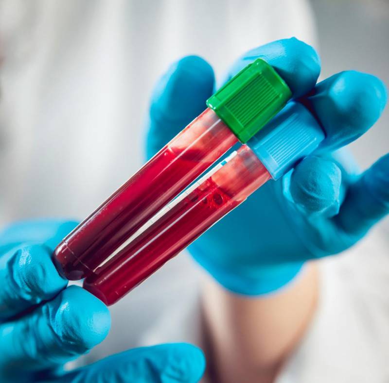 Анализ крови на электролиты: описание, сдача анализа, норма и отклонения, особенности
