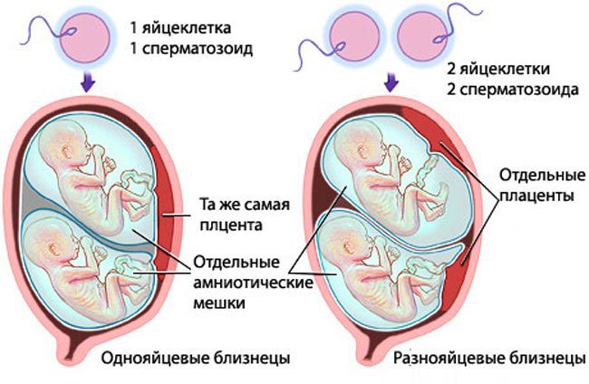 Беременность двойней по неделям фото