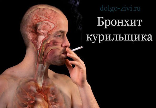 бронхи курильщика
