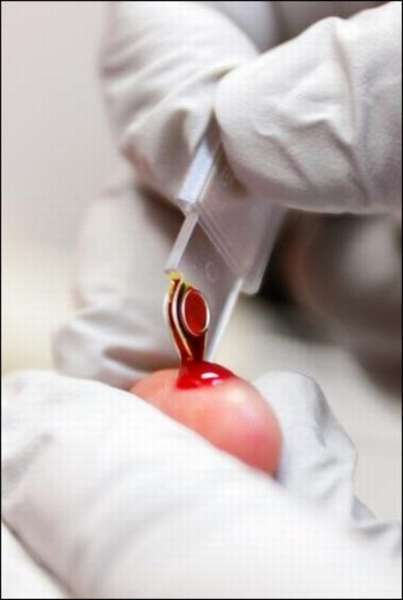 Что нужно знать для сдачи крови из пальца? Какие показатели определяет исследование?