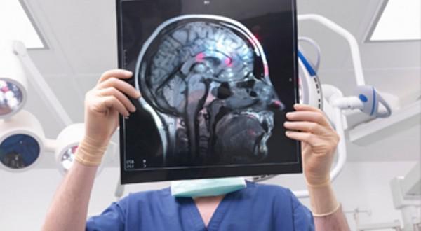 Что покажет МРТ головного мозга при рассеянном склерозе, особенности диагностики