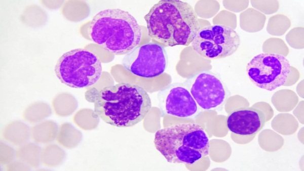 Что такое гранулоциты в анализе крови повышены