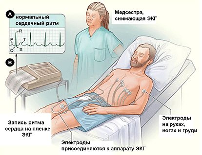Электрокардиография сердца