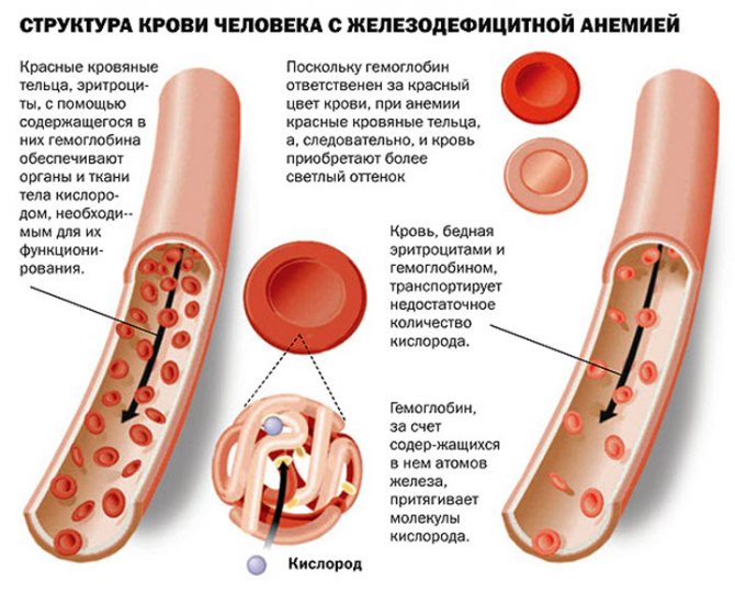 Эритроциты при анемии