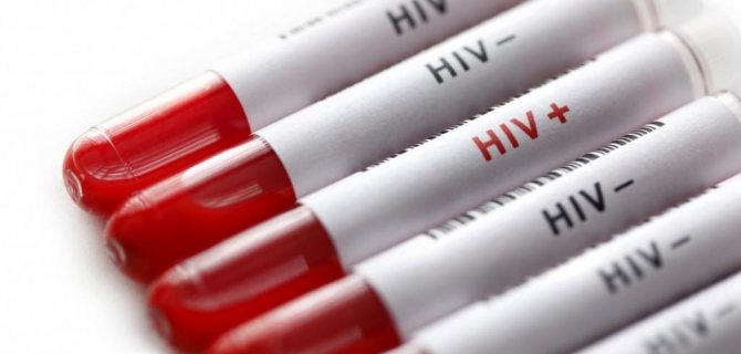 Ложноположительный результат анализа на ВИЧ