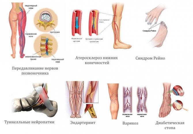 Магнитно-резонансная томография ног: как делают и какие заболевания выявляет