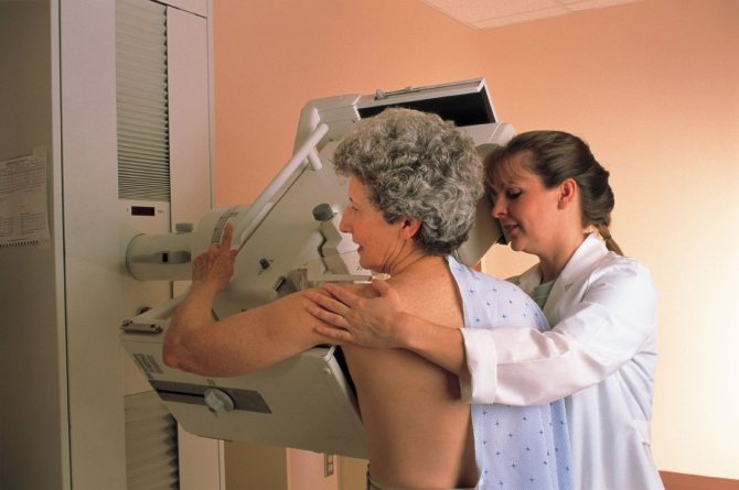 маммография