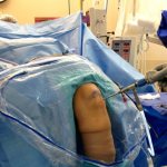 Миниинвазивная операция на колене
