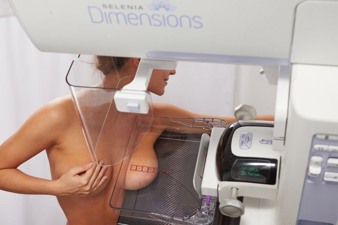 МРТ молочной железы: сравнение методик с УЗИ, маммографией, КТ