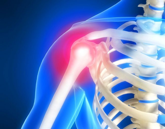МРТ плечевого сустава как проводят и что можно обнаружить
