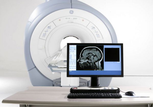 На мониторе – обработанная картинка томографии мозга