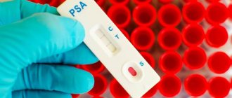 Нормы показателя ПСА при аденоме простаты, как снизить PSA народными ...