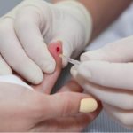 Общий анализ крови на рак из пальца