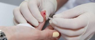 Общий анализ крови на рак из пальца