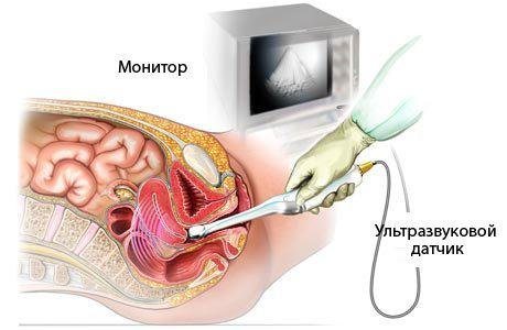 Первое УЗИ при беременности: диагностика патологий