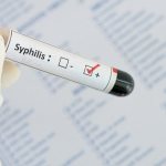 Положительный анализ на сифилис: ложный анализ, положительный ...