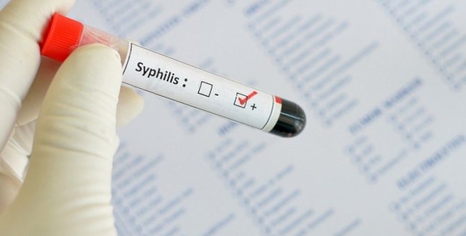 Положительный анализ на сифилис: ложный анализ, положительный ...