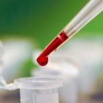 Повышены лейкоциты в крови у ребенка: причины и лечение