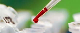 Повышены лейкоциты в крови у ребенка: причины и лечение