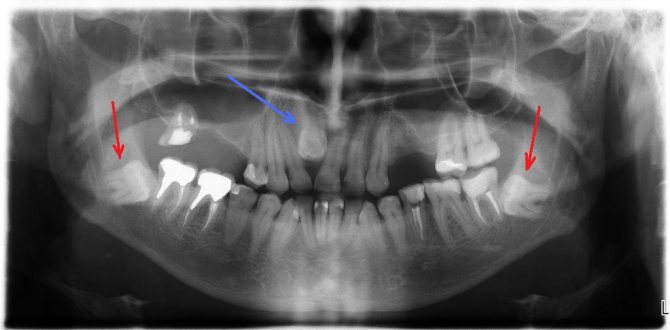 Пример 3d снимка зубов