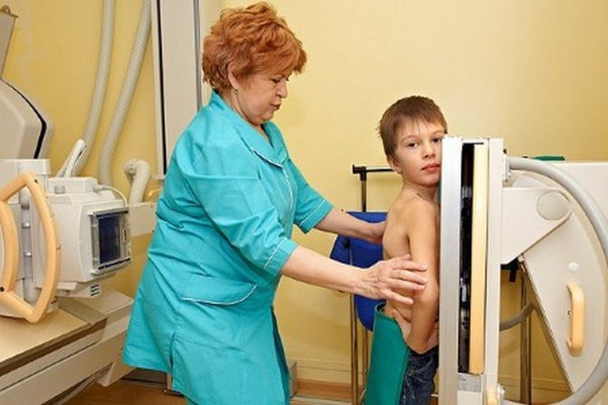 Рентгенография грудной клетки ребенка