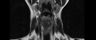 Снимок МРТ мягких тканей шейного отдела