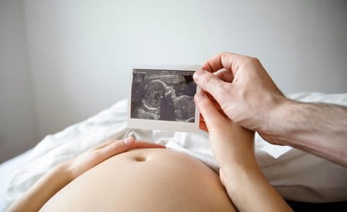 Снимок УЗИ на 23-25 неделях беременности