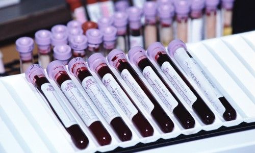 Сучасний ерс анализ крови: що це?