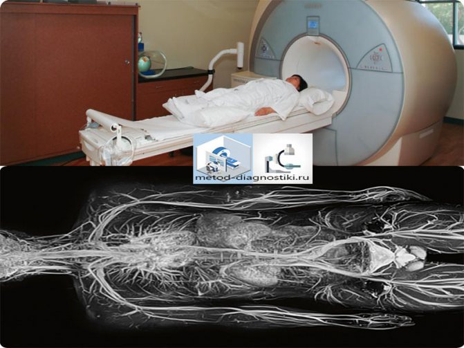 тело на томографе и после сканирования
