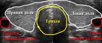 ультразвуковое изображение шеи с указанием расположения щитовидной железы