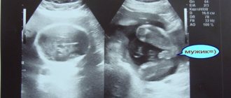УЗИ на 12 неделе беременности: фото, пол ребенка, размер плода