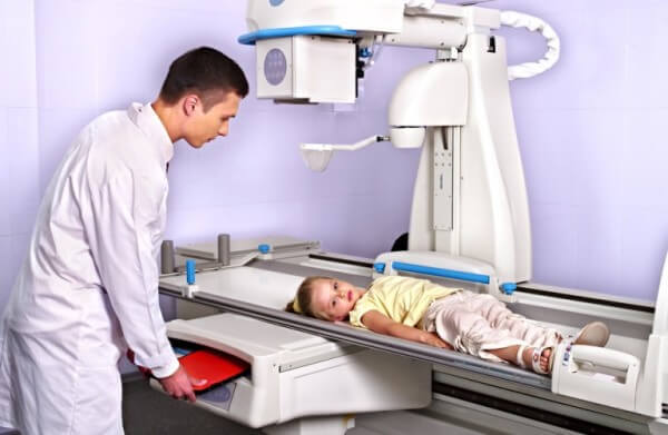 Видно ли на рентгене воспаление легких: как расшифровать снимок ребенка — Ваш Доктор