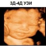 Виды УЗИ при беременности